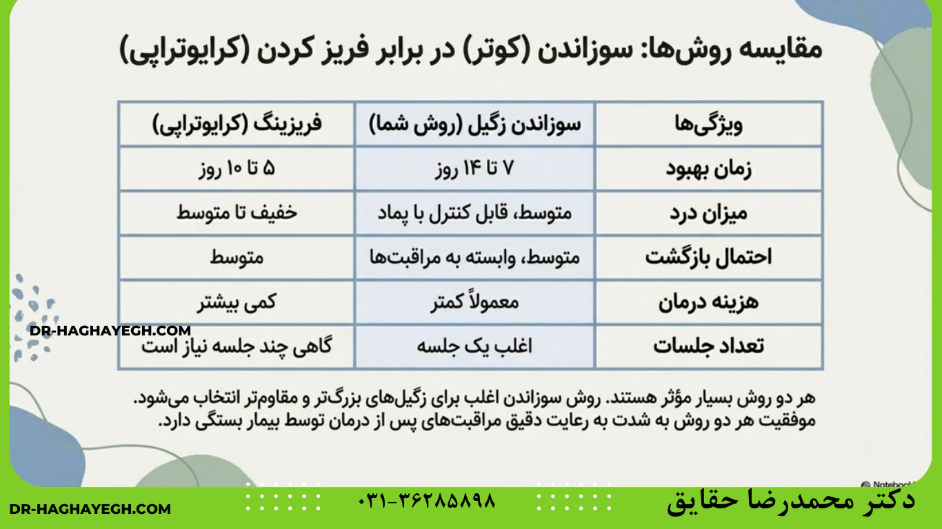 مقایسه روش سوزاندن زگیل تناسلی با روش فریزینگ (کرایوتراپی)