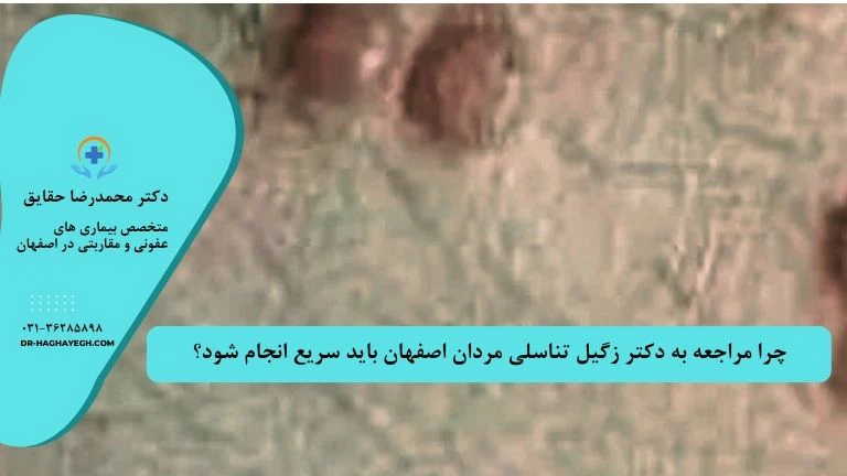 دکتر زگیل تناسلی در اصفهان | بهترین متخصص زگیل پزشک زگیل تناسلی اصفهان